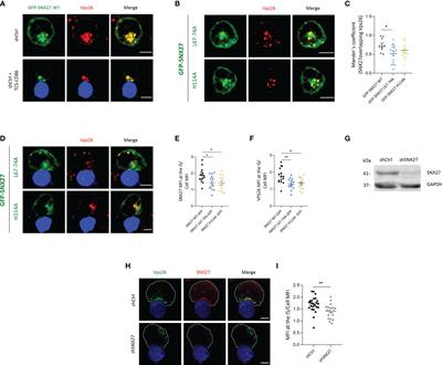 Sorting Nexin 27 Enables MTOC and Secretory Machinery Translocation to the Immune Synapse